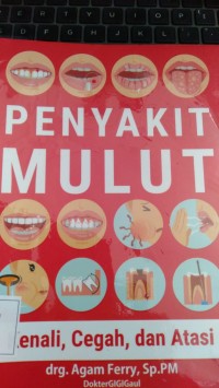 PENYAKIT MULUT KENALI CEGAH DAN ATASI